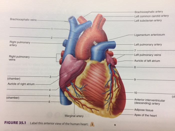 Figure 11-2 is an anterior view of the heart